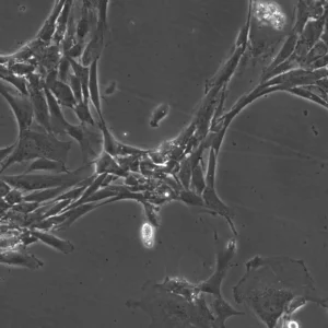 Wilms11 Cells