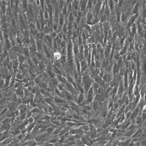 Wilms2 Cells