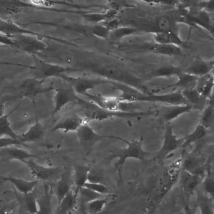 Wilms3 Cells