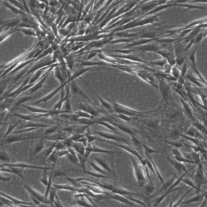 Wilms6 Cells