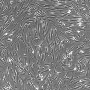 Wilms8 Cells